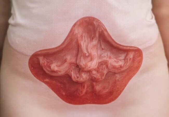 Brązowy Śluz Zamiast Miesiączki – Przyczyny i Kiedy Zgłosić Się do Lekarza